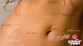 از بین بردن ترک های پوست