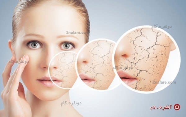 پیشگیری از پیری زودرس