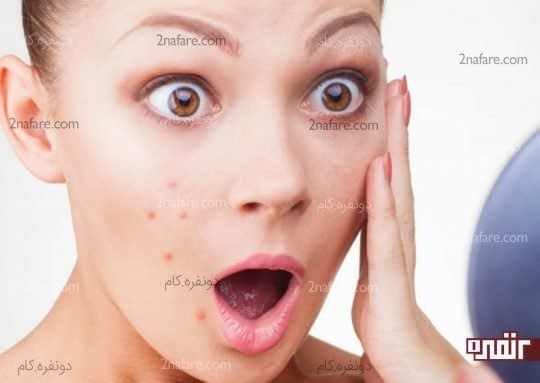 برخی از آسیب های پوستی صورت که نشانگر کمبود مواد مغذی در بدن هستند