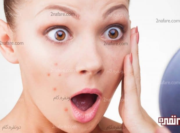 برخی آسیب های پوستی ناشی از کمبود مواد مغذی برخی از آسیب های پوستی صورت که نشانگر کمبود مواد مغذی در بدن هستند