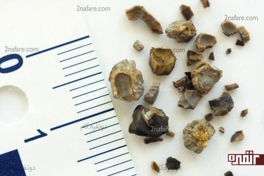 غذاهای کلسیم دار بخورید تا سطح اگزالات رو کاهش بدین