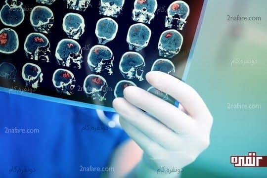 نقش تفاوت مغز افراد در ابتلا به نارساخوانی