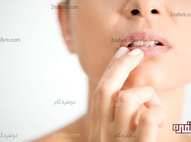 تبخال چطور درمان میشود؟ انتقال تبخال