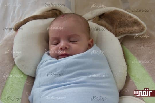 پهلو درد در نوزاد