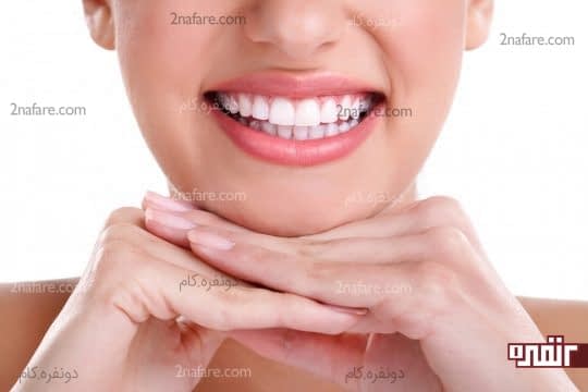 لبخند زیبا داشته باشید