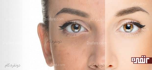 دلیل و درمان ناهماهنگی رنگ پوست صورت ناهماهنگی رنگ صورت