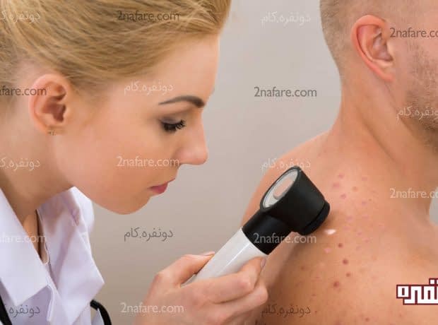 روش از بین بردن جای جوش و لک در طب سنتی درمان جای جوش
