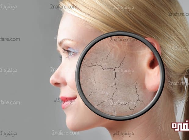 درباره ی پسوریازیس چه میدانید؟ پسوریازیس