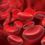 چه غذاهایی برای درمان کم خونی مفیدند؟
