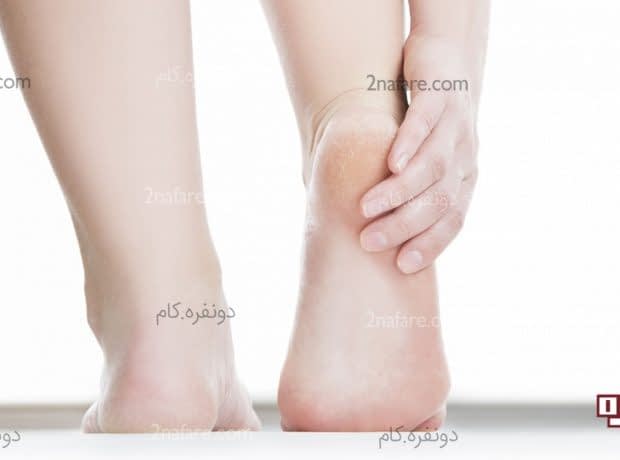 چطور از شر ترک پا خلاص بشیم؟ ترک پا و راههای درمان آن در منزل