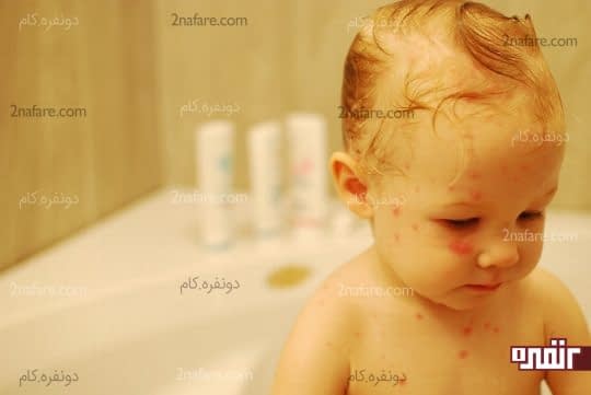 حموم کردن کمی میتونه تسکین دهنده باشه