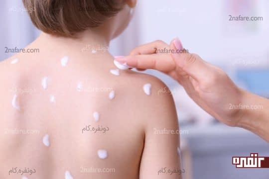 کرم های ضد خارش یه ترفند مناسب