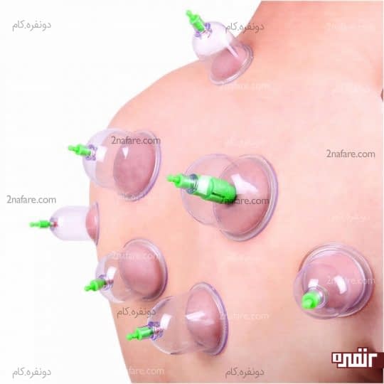 علت حجامت