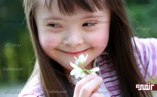 خطر ابتلای نوزاد به سندرم داون
