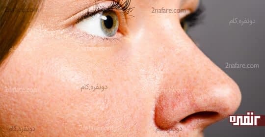 ترمیم منافذ پوست با ماسک چای سبز