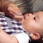 درمان برفک دهان در نوزاد