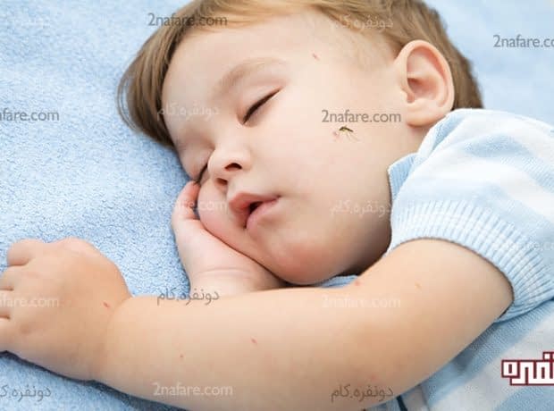 گزیدگی پشه در کودکان و روش های درمان آن گزیدگی پشه در کودکان و روش های درمان آن