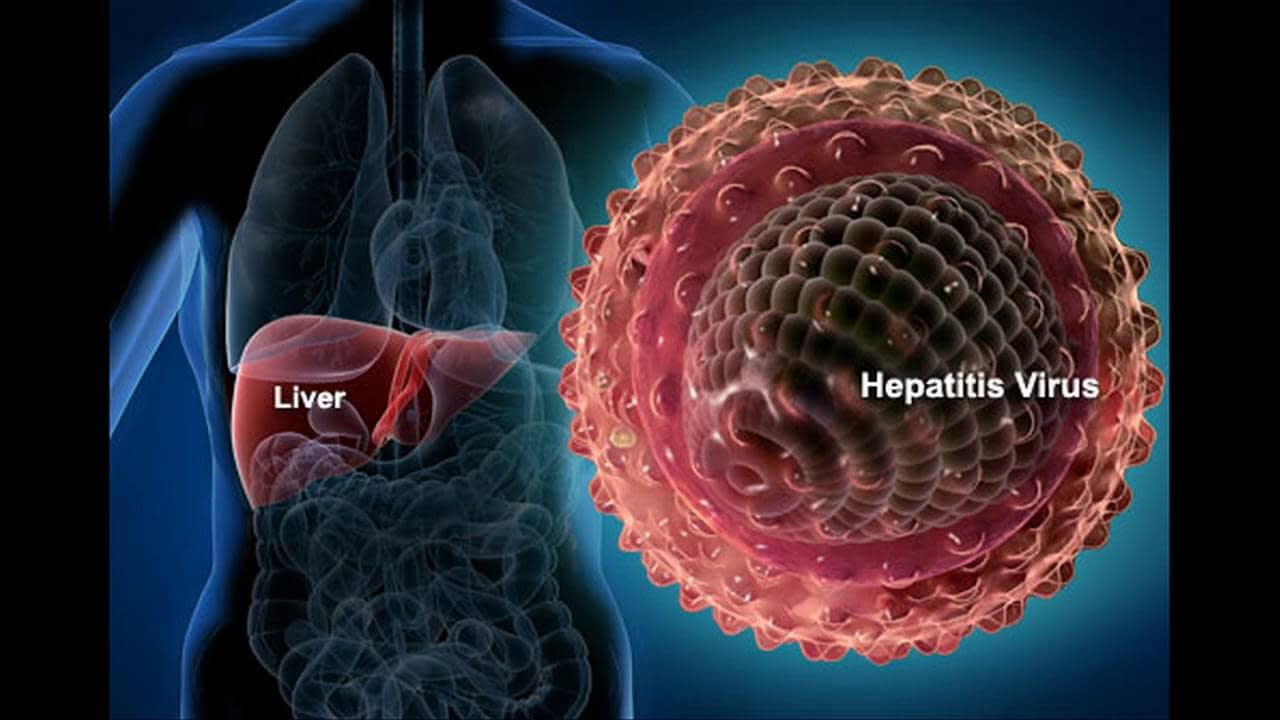 هپاتیت چیست؟ انواع هپاتیت و روش های انتقالش