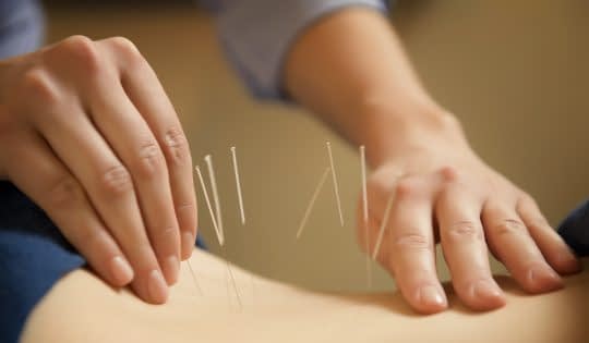 طب سوزنی یکی از روش های موثر در کاهش وزن