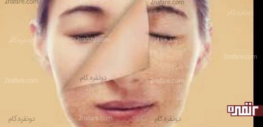 از بین برنده خشکی پوست