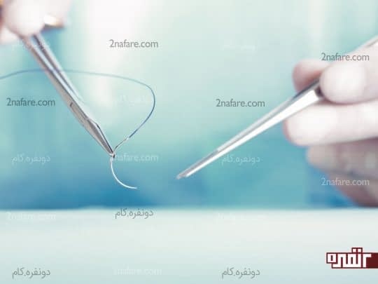 انواع نخ بخیه و عوارض باقی ماندن نخ بخیه در بدن