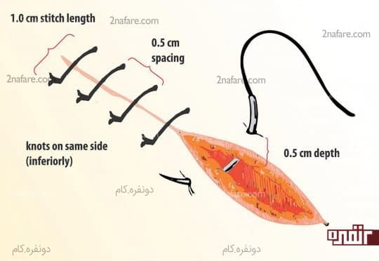 دوخت ماتریسی