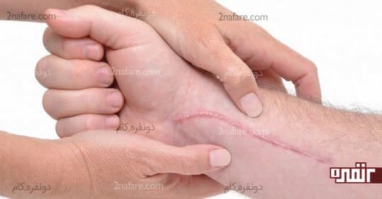 عوارض ماندن نخ بخیه در بدن