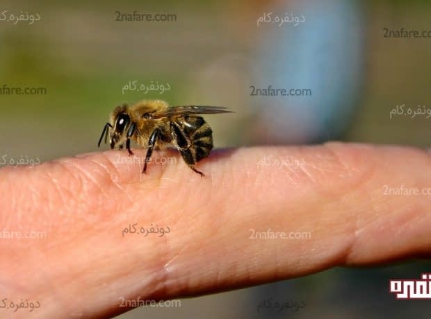 درمان خانگی نیش زنبور عسل درمان نیش زنبور عسل