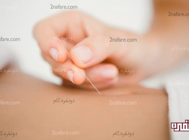 طب سوزنی برای لاغری شکم طب سوزنی برای لاغری شکم