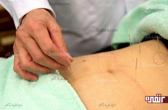 نقطه ی بهبود دهنده ی سوخت و ساز