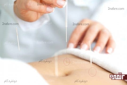 نقطه ی تسکین یبوست