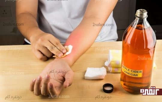 سرکه سیب عفونت ناشی از نیش پشه رو درمان میکنه