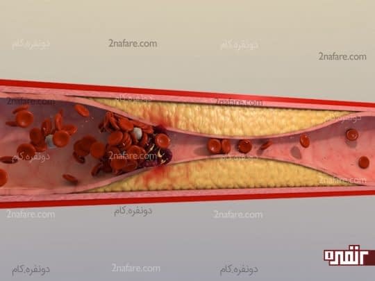 کلسترول خون