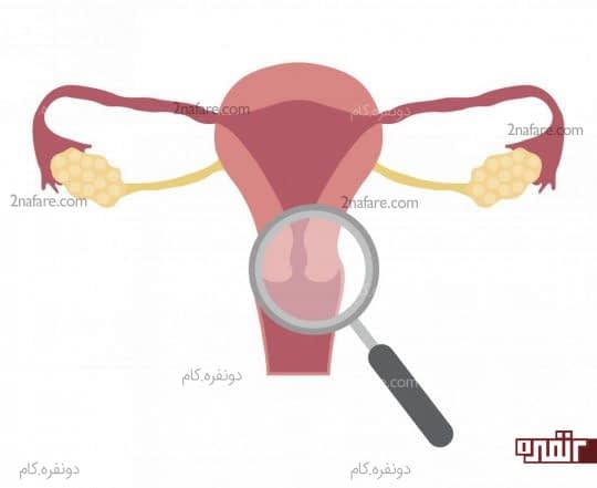 گردن رحم