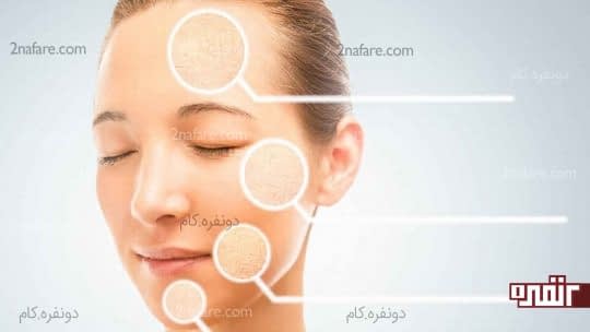درمان خشکی پوست با ماسک سیب زمینی