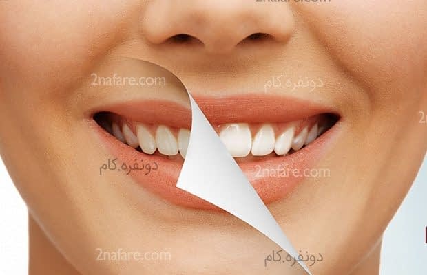 سفید کردن دندان ها با استفاده از جوش شیرین سفید کردن دندان ها با استفاده از جوش شیرین