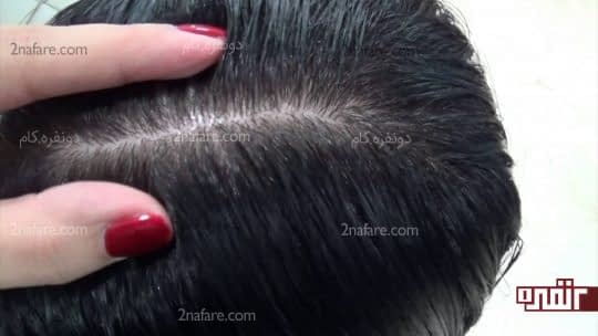 تشخیص نوع پوست سر برای انتخاب محصولات مراقبت از مو