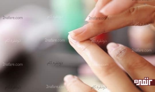 درمان لکه های سفید روی ناخن