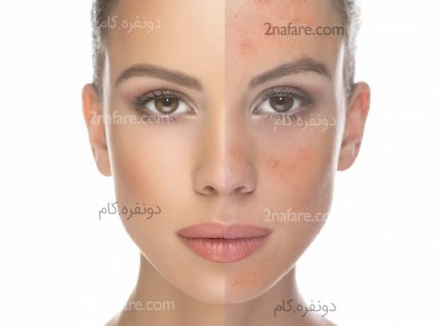 ۲ ماسک خانگی موثر برای داشتن پوست روشن