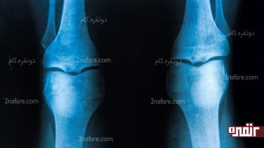 محافظت از استخوان ها با چای قاصدک