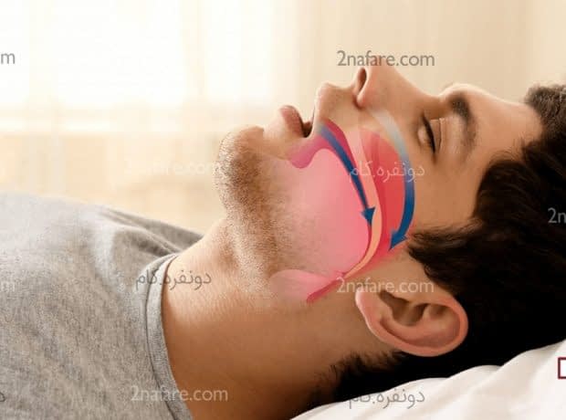 راهکارهای طبیعی برای درمان اختلال تنفس در خواب (آپنه خواب) راهکارهای طبیعی درمان آپنه خواب