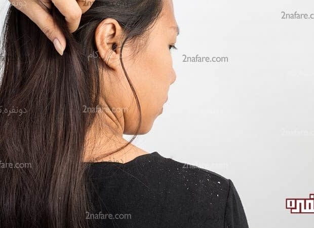 چطور از روغن کرچک برای از بین بردن شوره سر استفاده کنیم؟