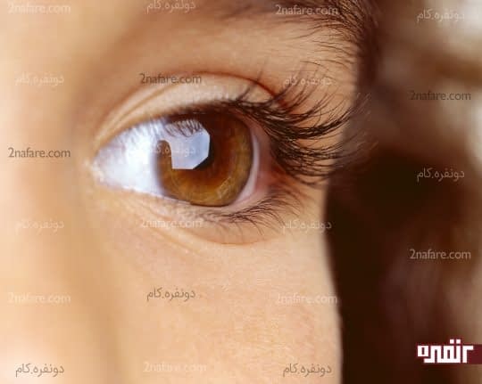 سلامت چشم را ارتقا می بخشد