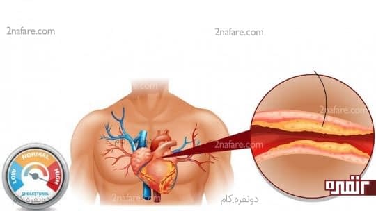 کلسترول را کاهش می دهد